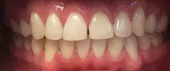 Clínica dental en ciudad Nuevo Laredo México